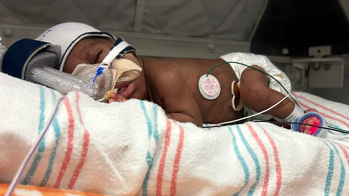 Support Baby E's Premature Journey campaign photo, 1 of 3
