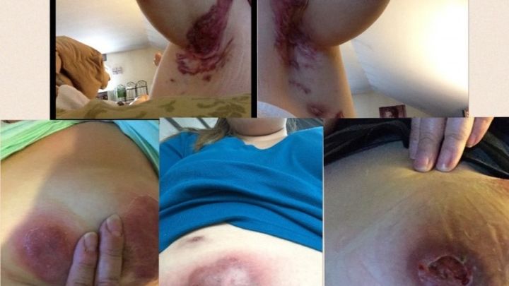 Much Needed Surgery at HS Institute campaign photo, 1 of 3