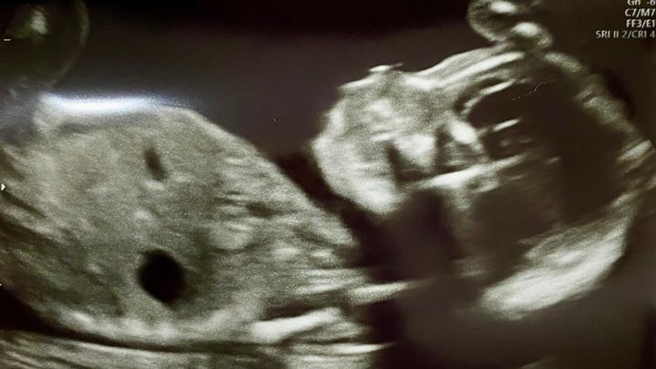 Support Tiffany & Matthew’s (AKA Cabbages) New Baby Journey campaign photo, 1 of 6