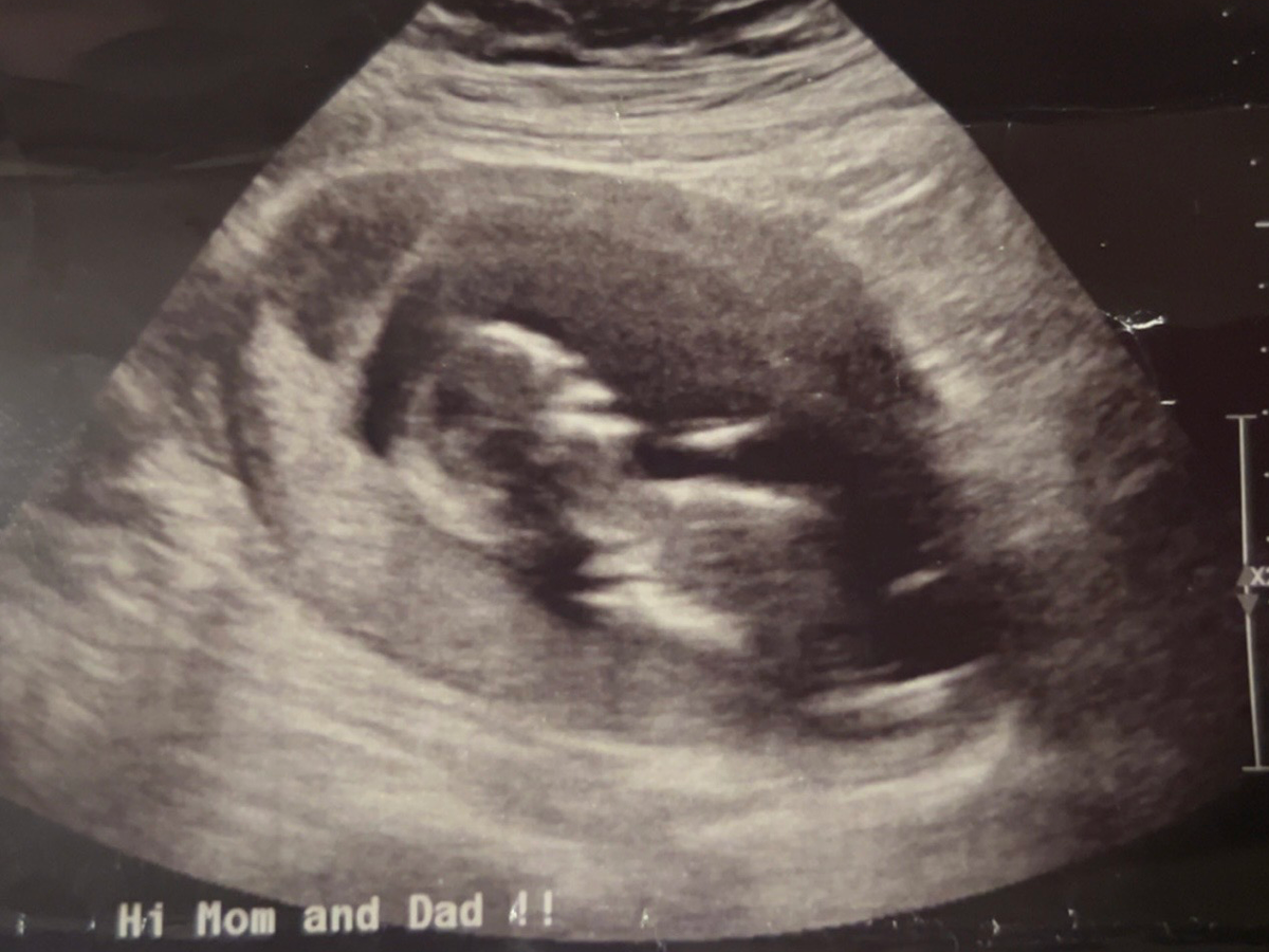 Help Lay Our Angel Baby to Rest campaign photo, 1 of 3
