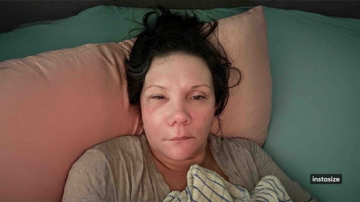 Aid Lindsay's Critical Dental Surgery Fund campaign photo, 1 of 8