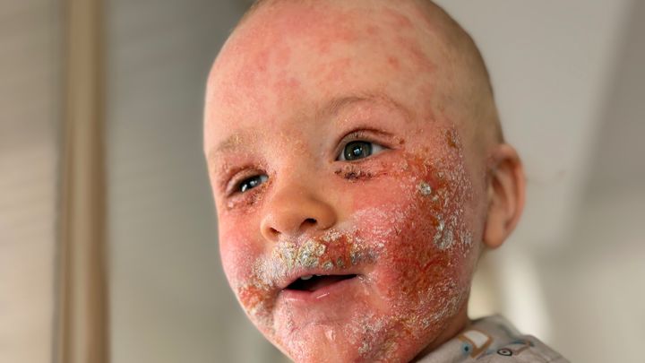 Help us get Charlie to Bali