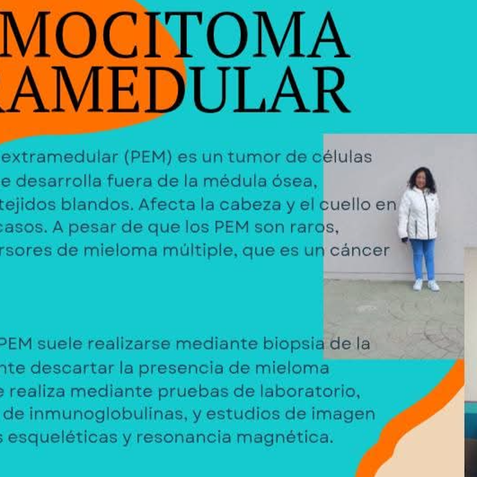 Karla Ovando Plasmocitoma Extramedular
