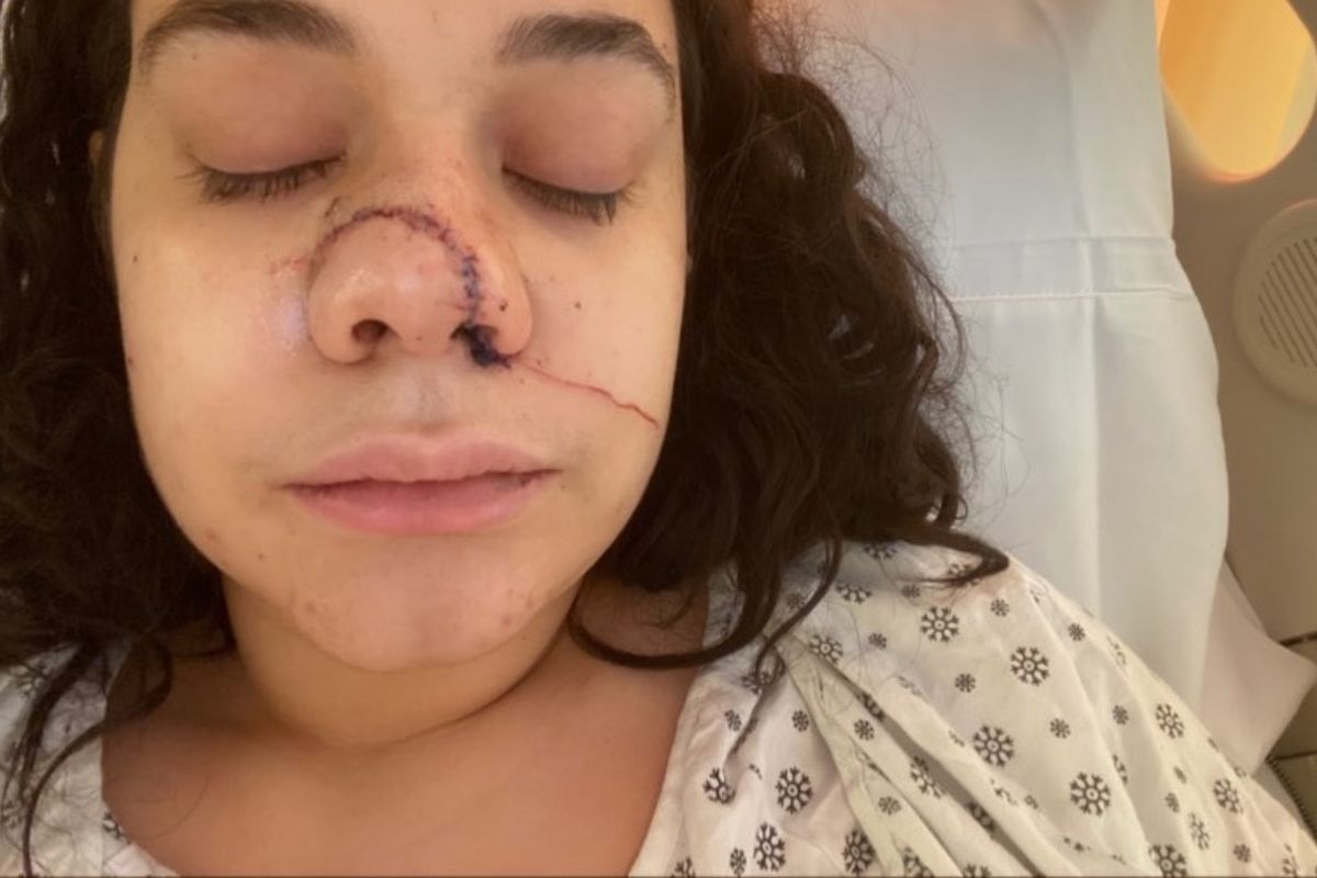 Fundraiser by Desteny S. : Women Slashed in face by stranger