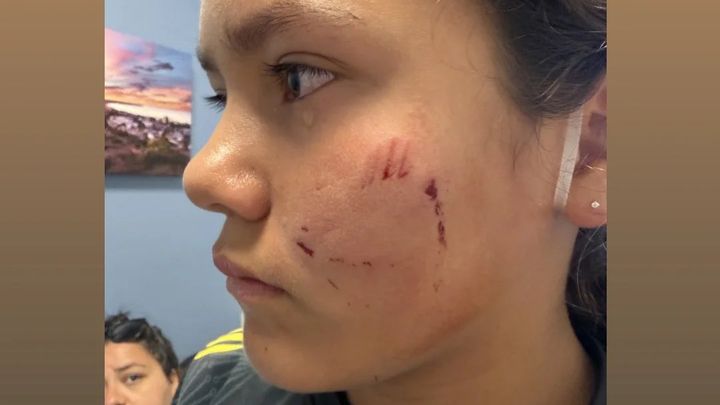 Help Kailie and Her Dogs Recover campaign photo, 1 of 5