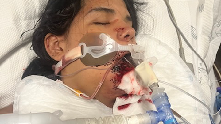 Help Aliciana Heal after Surviving 11 Gunshot Wounds campaign photo, 1 of 8