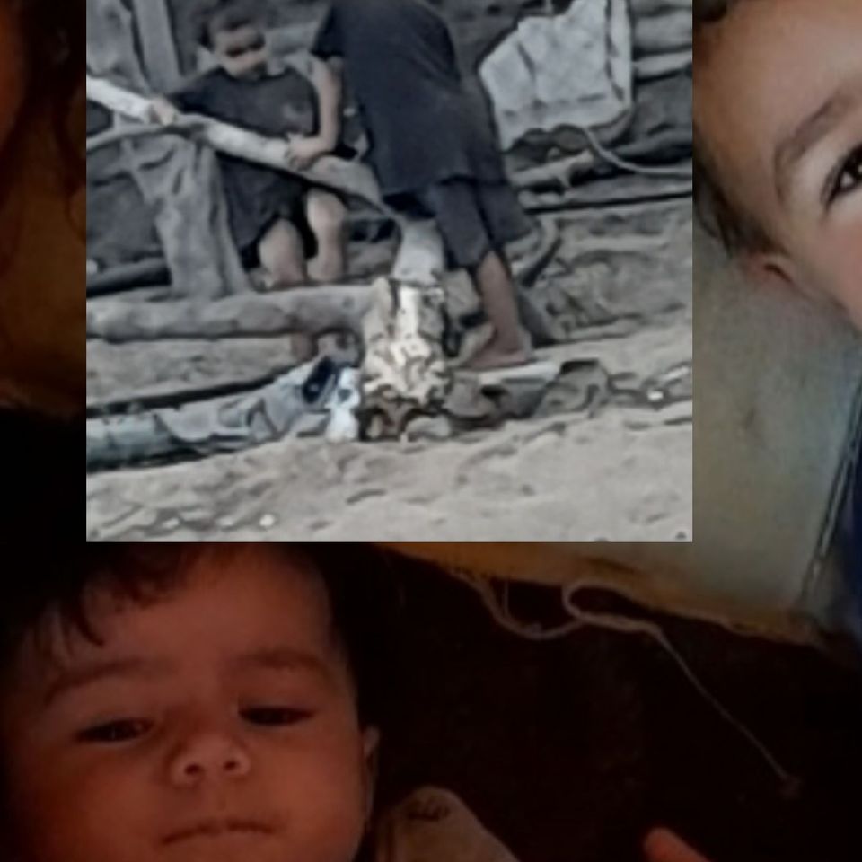 Help baby Mila & her family live a normal life
