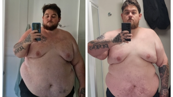 Support Nik's Weight Loss Surgery Journey campaign photo, 1 of 4