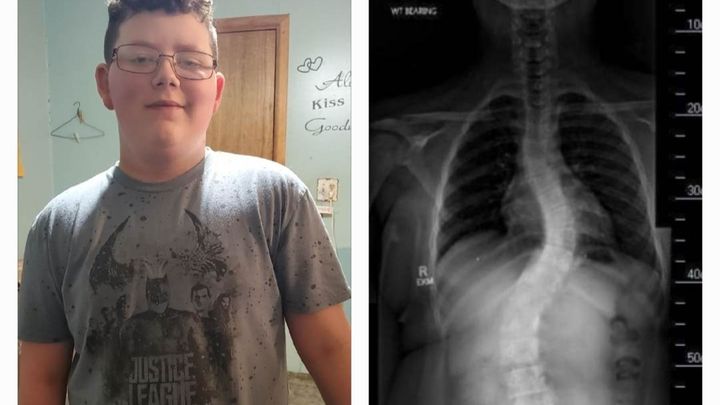 Fundraiser by Micah Neeley : Logan Burns travel expensive for surgery