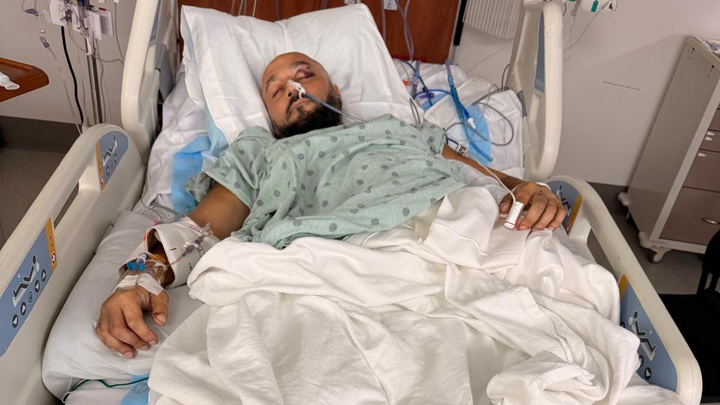 Help Luis Recover After a Devastating Motorcycle Accident campaign photo, 1 of 8