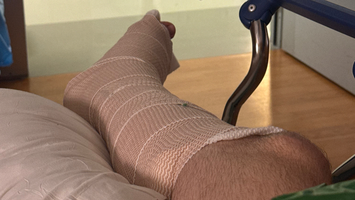 Help 22 Year Old Will Holton Afford Foot Surgery campaign photo, 1 of 8
