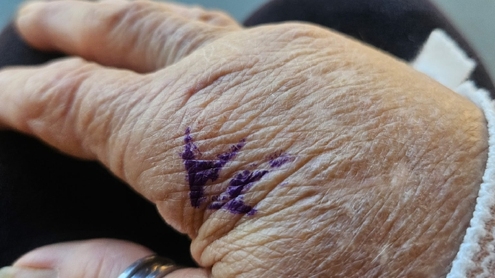 Help Anna Temple Recover from Elbow Surgery campaign photo, 1 of 8