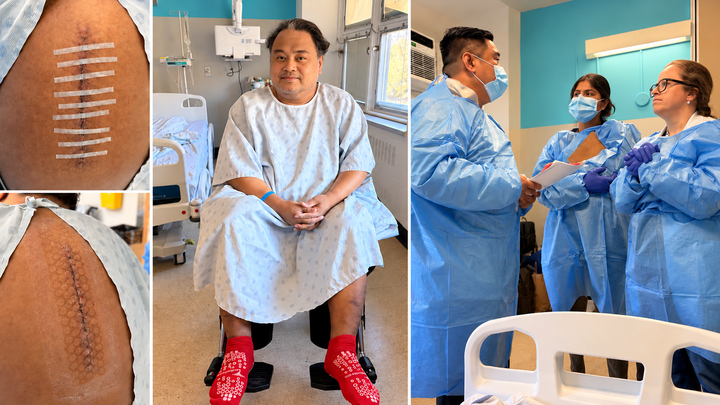 Help Alvin Walk Again After Emergency Spine Surgery campaign photo, 1 of 7