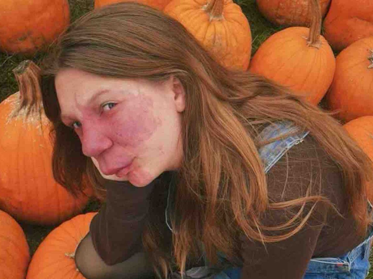 Help Ava Get Life-Changing Treatment campaign photo, 1 of 10