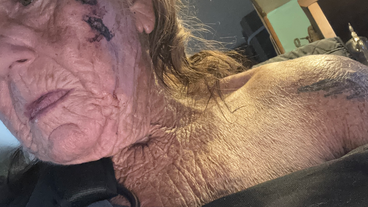 Please help stitches campaign photo, 1 of 3