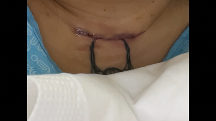 Radiation Treatment After Insurance Denial campaign photo, 1 of 9