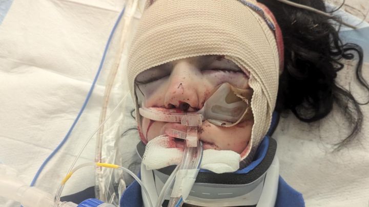 Support Brianna's Long Road to Recovery campaign photo, 1 of 3