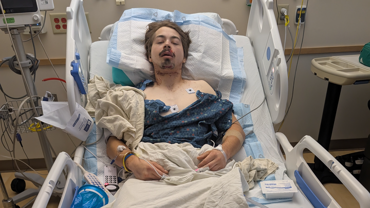 Help Jacob Recover from His Severe Injuries campaign photo, 1 of 8