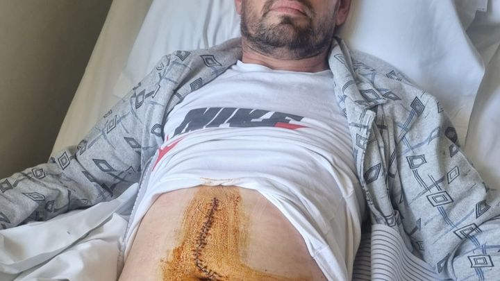 Stabbed for Stopping Crime: Help Ibrahim Fund His 4th Surger campaign photo, 1 of 7