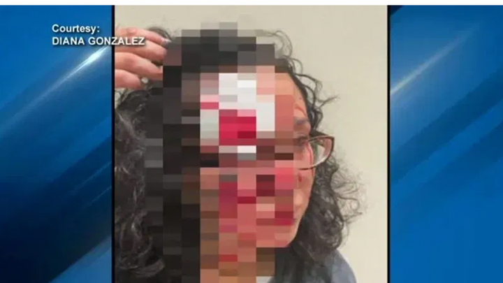 Recovery After a Seattle Hate Crime campaign photo, 1 of 3