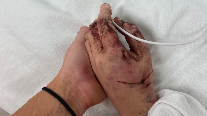 Help my Cousin Recover After a Devastating Car Accident campaign photo, 1 of 3