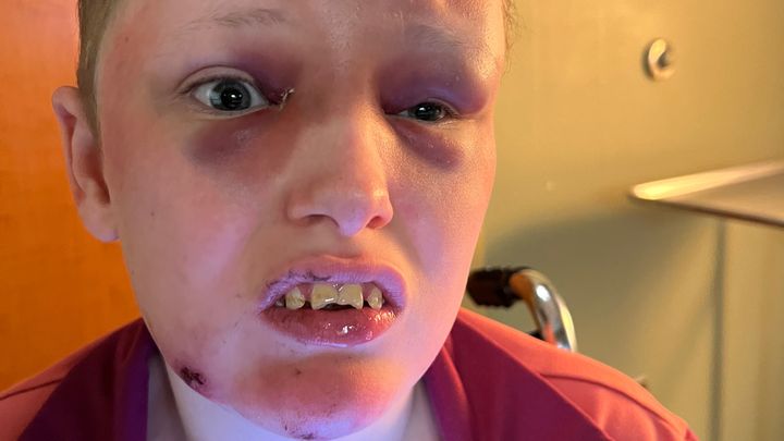 Help My Daughter Get Critical Autism Care campaign photo, 1 of 8
