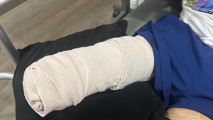 Foto della campagna Cristian's Recovery After Emergency Surgery, 1 di 7