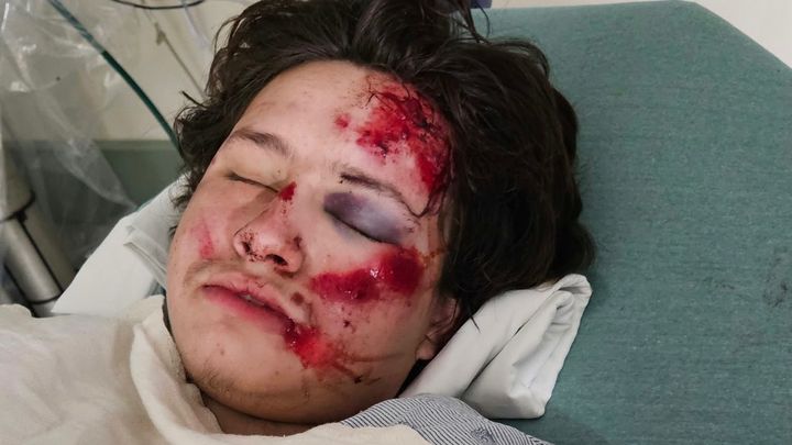 Support My Nephew After Hit and Run campaign photo, 1 of 3