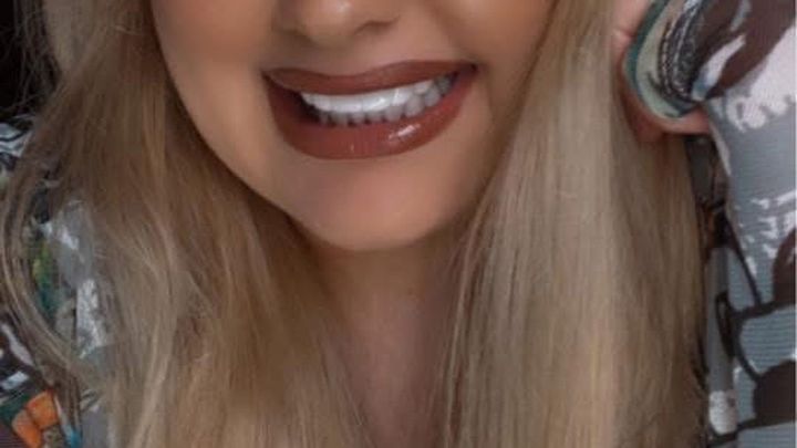 Help Restore My Smile After Accident campaign photo, 1 of 6