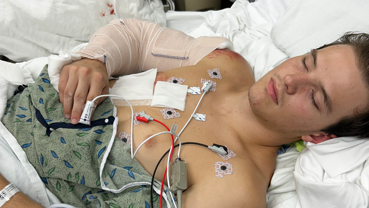 Support Derek Harrison's Painful Road to Recovery campaign photo, 1 of 5
