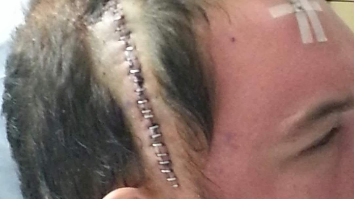 Help Ed Ore's Family Battle Brain Cancer campaign photo, 1 of 7