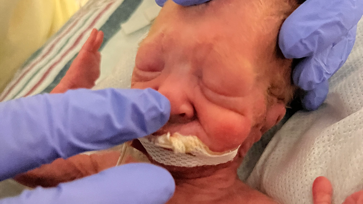 Support for Emoreigh’s NICU Journey campaign photo, 1 of 4