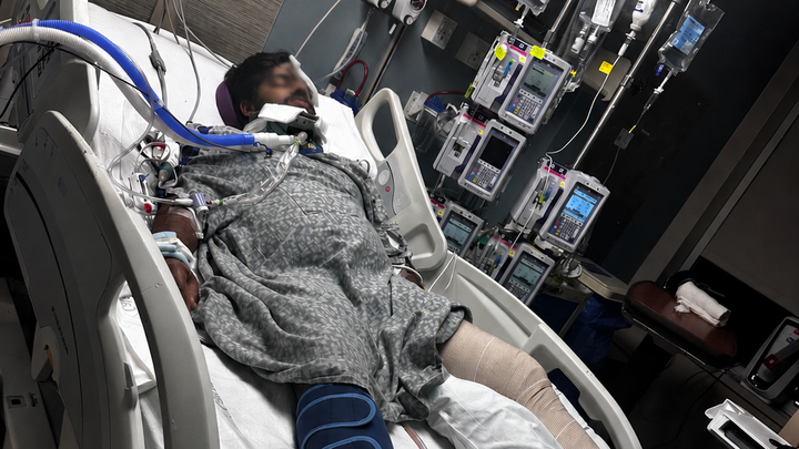 Help Saiteja Recover After Car Accident
