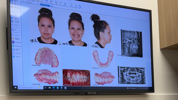 Shell’s braces for the next two years campaign photo, 1 of 4
