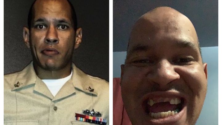 Fundraiser by Gretchen Smith : US NAVY VET JOSH NEEDS TEETH