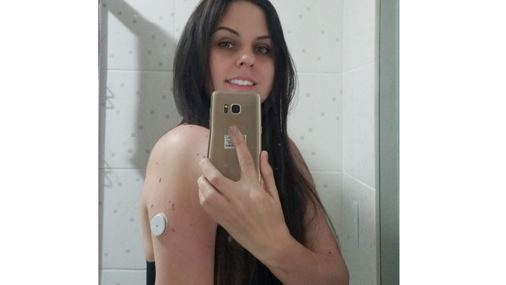Insulin pump for diabetic type 1 campaign photo, 1 of 7