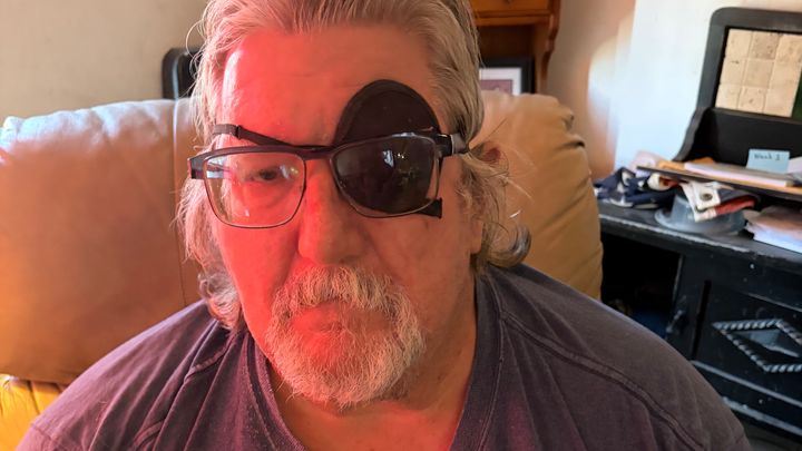 Help Jimmy Save His Sight campaign photo, 1 of 3