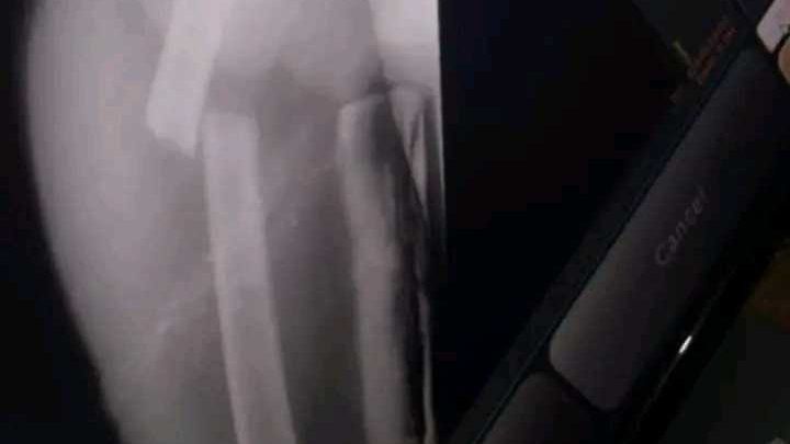 Help me revover after a serious accident campaign photo, 1 of 7