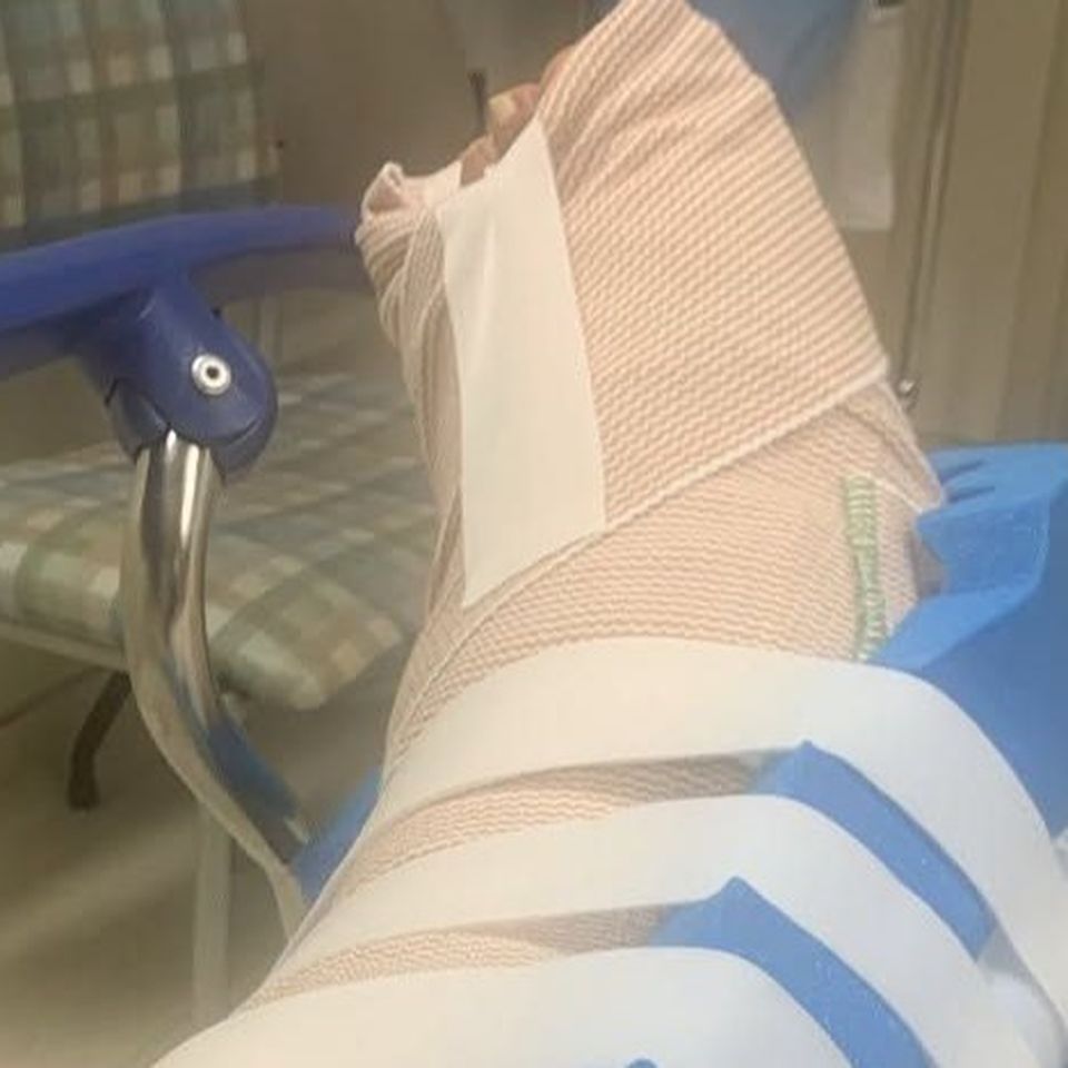 Support Graffbat After Injury During Paint Louis