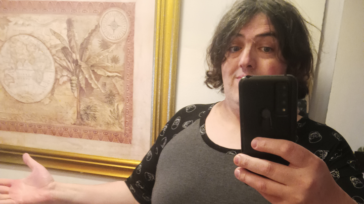 Jenny's Facial Feminization Surgery fundraiser! campaign photo, 1 of 3