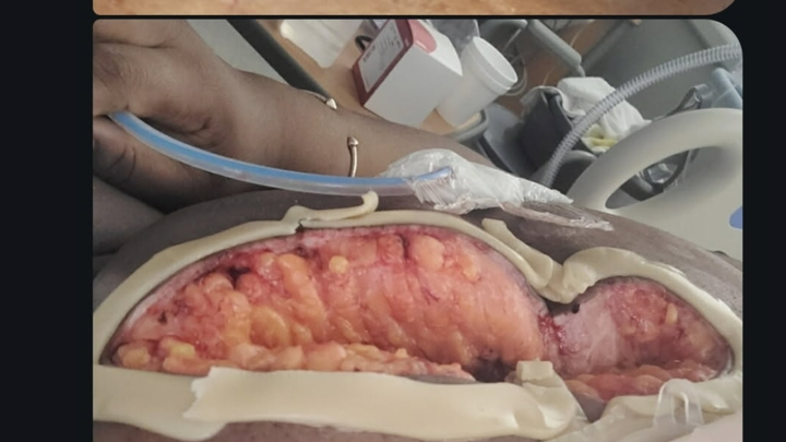 Donate to Cassandra Wright's Medical and Housing Needs campaign photo, 1 of 4