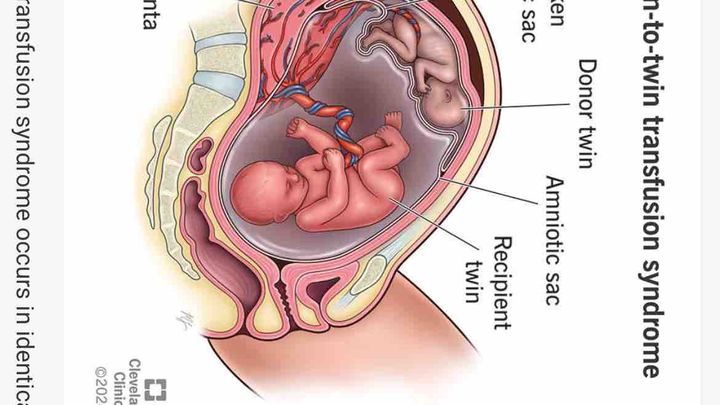 Help cover surgery to save my baby boys life’s campaign photo, 1 of 4