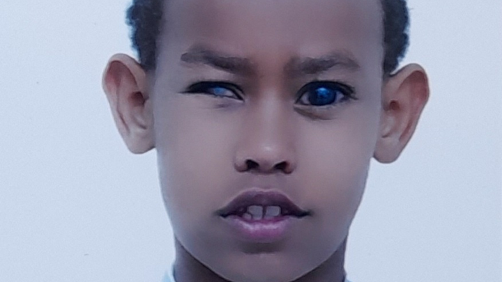 Help Save Esey’s Remaining Vision campaign photo, 1 of 5