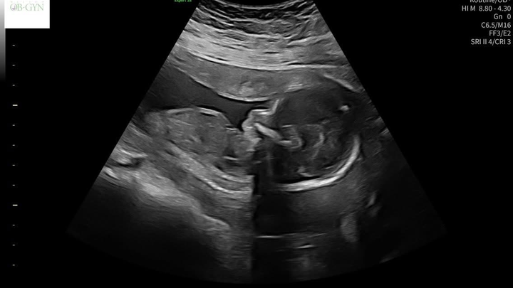 A Peaceful Rest for Baby Kolsen campaign photo, 1 of 3