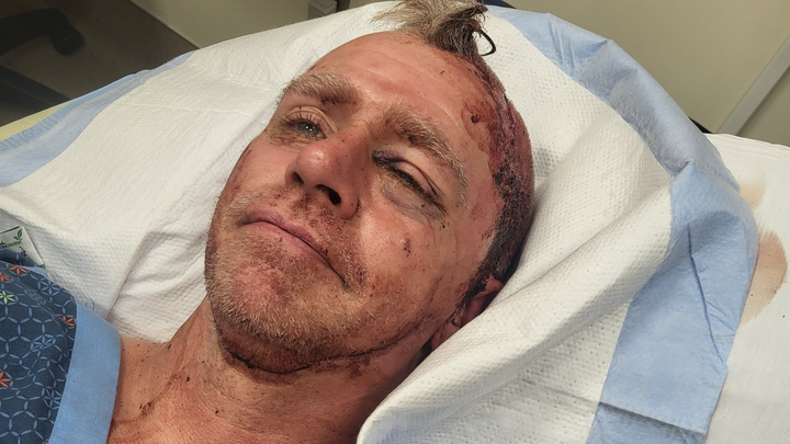 Jules Moss Recovery Fund campaign photo, 1 of 4