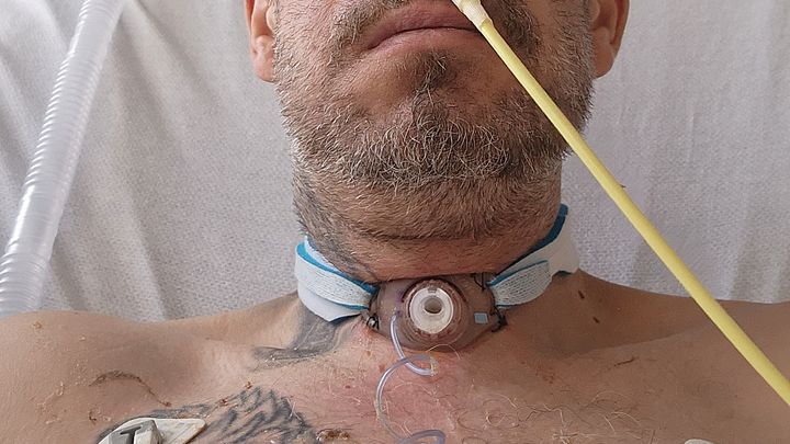 Foto principal de la recaudación de fondos