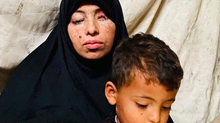 Sostieni Rawan e suo figlio – Da Gaza, per la speranza campaign photo, 1 of 6