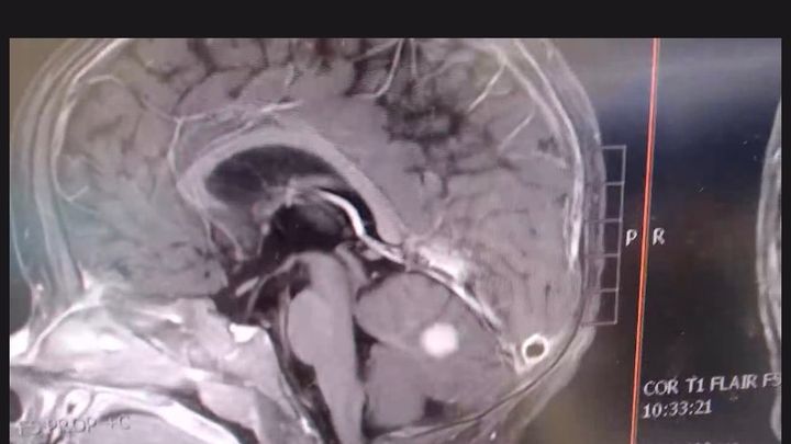 Support Asher’s Brain Surgery and Recovery campaign photo, 1 of 7