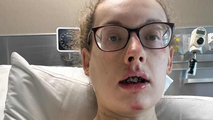 Help Blair Get Her Smile Back After Crash campaign photo, 1 of 8
