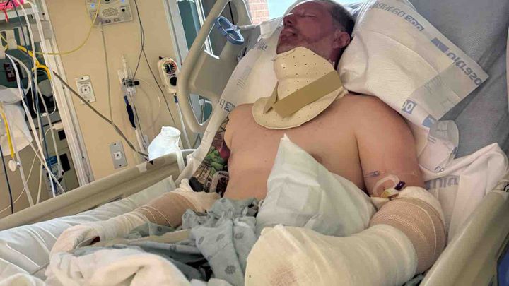 Help Bruce & Family after Electrical Explosion campaign photo, 1 of 11
